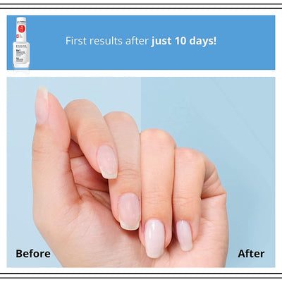 Nail Therapy Total Action 8 in 1 Intensive Nail Conditioner